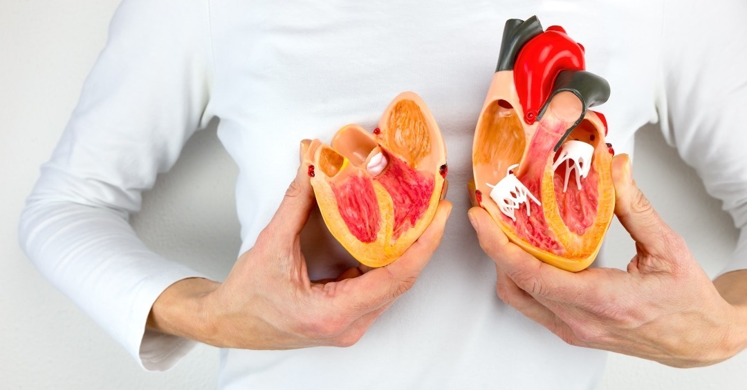 Koronarna bolest srca: Tiha opasnost koje mnoge žene nisu svesne